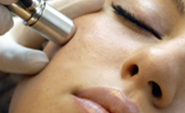 Microdermabrasion und Fruchtsäurebehandlung