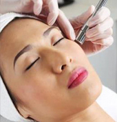 Microdermabrasion